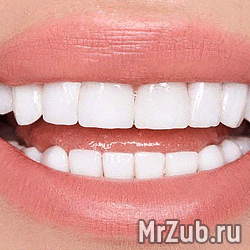 Emax и цирконевые коронки в Новом Измайлове
